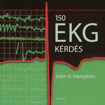 150 EKG KÉRDÉS (2014)