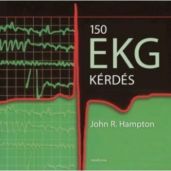 150 EKG KÉRDÉS (2014)